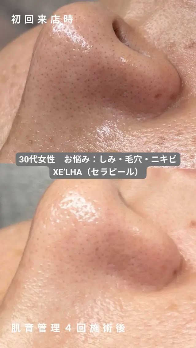 エステ cocofleur 美容看護師監修サロンのエステ・リラクイメージ