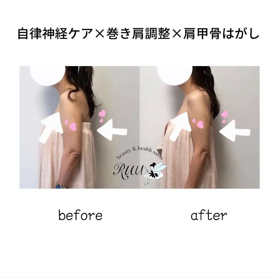 【頭痛、睡眠改善】 salon RUUのエステ・リラクイメージ
