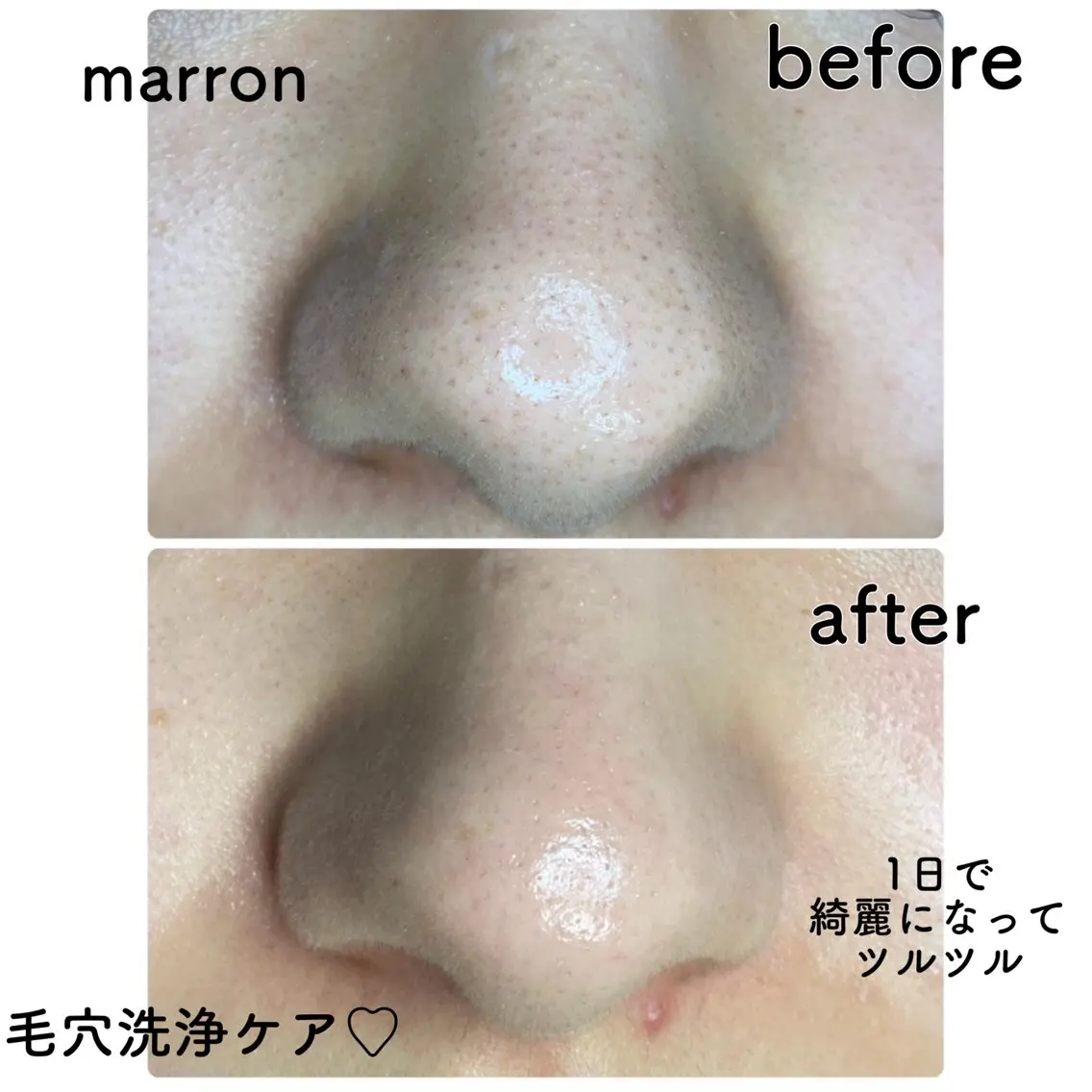 エステ 痩身ハイパーナイフ ララピールリアボーテのエステ・リラクイメージ