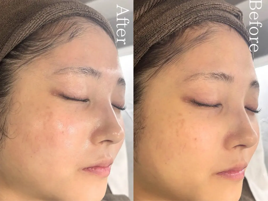 エステ 💎Queen Beauty🫧のエステ・リラクイメージ