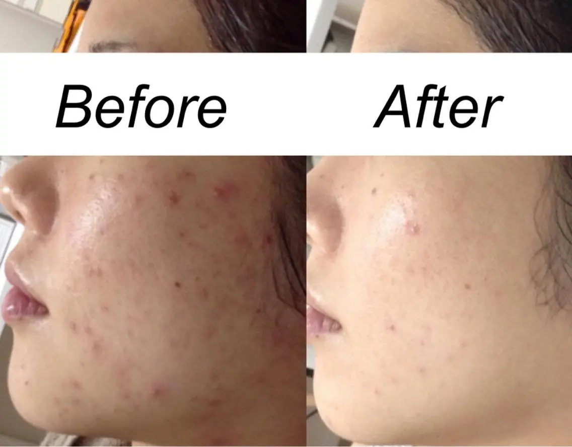 ミディアム カラー パーマ ヘアアレンジ キッズ ネイル マツエク・マツパ エステ リラク 都度払い肌質改善 &脱毛Blancheのエステ・リラクイメージ