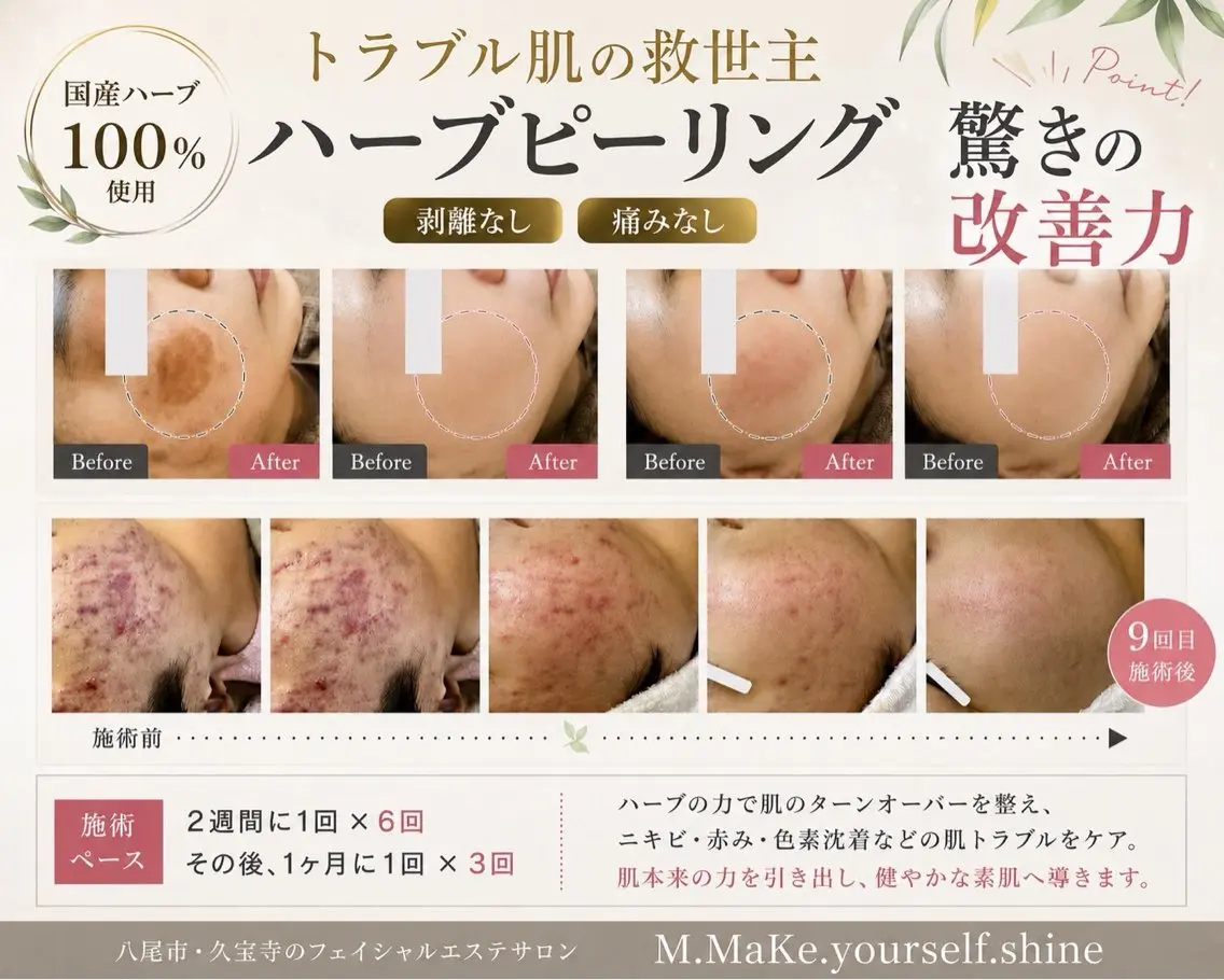 M salonのエステ・リラクイメージ