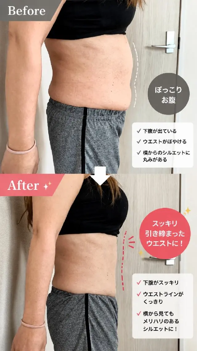 1日で完結‼️自分を愛しむ「巡り・締め・整え」フルコース✨（よもぎ蒸し × キャビテーション × 美容鍼）の写真
