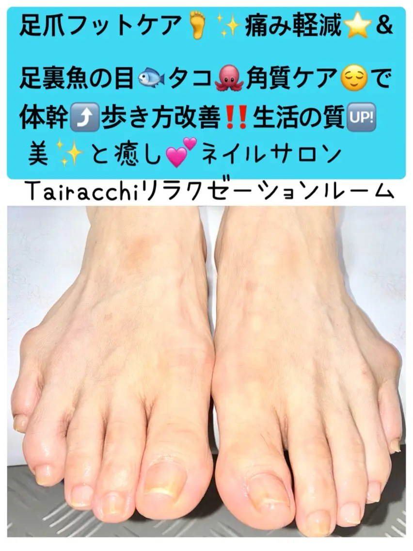 ネイル フットネイル Tairacchi タイラッチのエステ・リラクイメージ