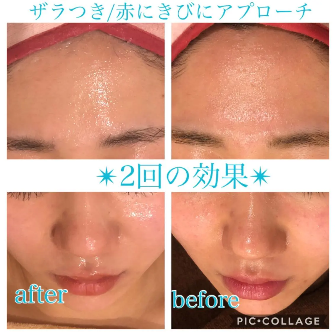ロング カラー パーマ ヘアアレンジ キッズ ネイル マツエク・マツパ エステ リラク EnsorClair 代表 野口真央のエステ・リラクイメージ