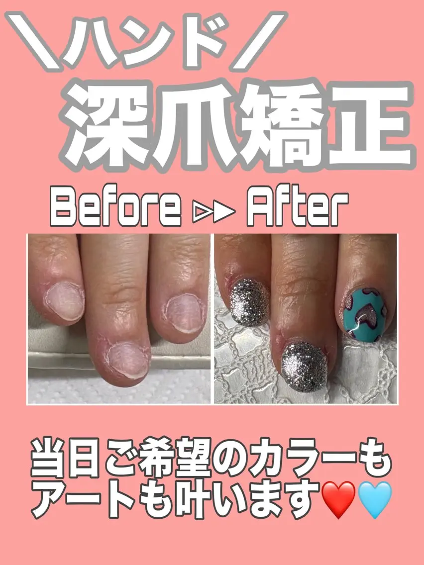 ネイル アートネイル ハート ぷっくりネイル ハンドネイル ハンドケア nail salon petillantのネイルデザイン