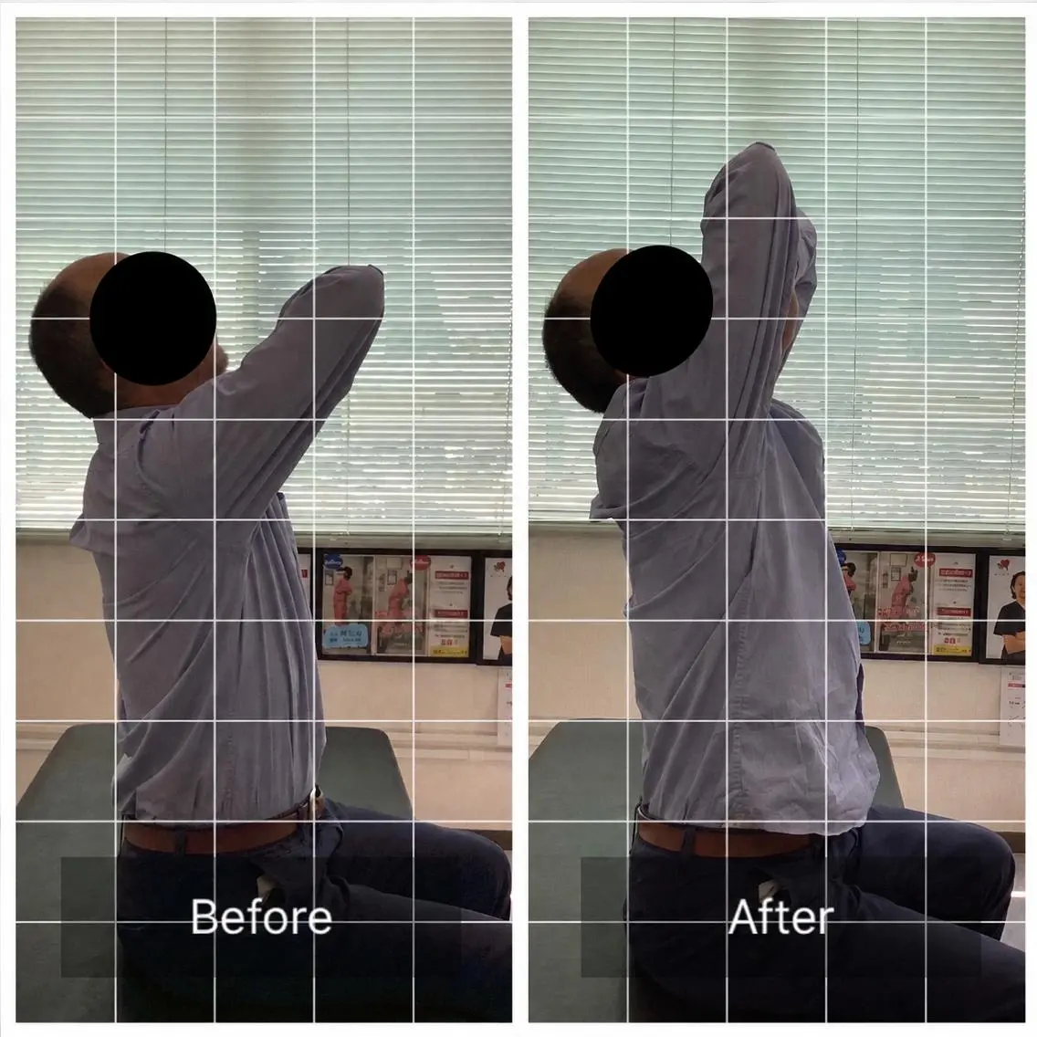 【初回】肩こり･首こり集中整体の写真