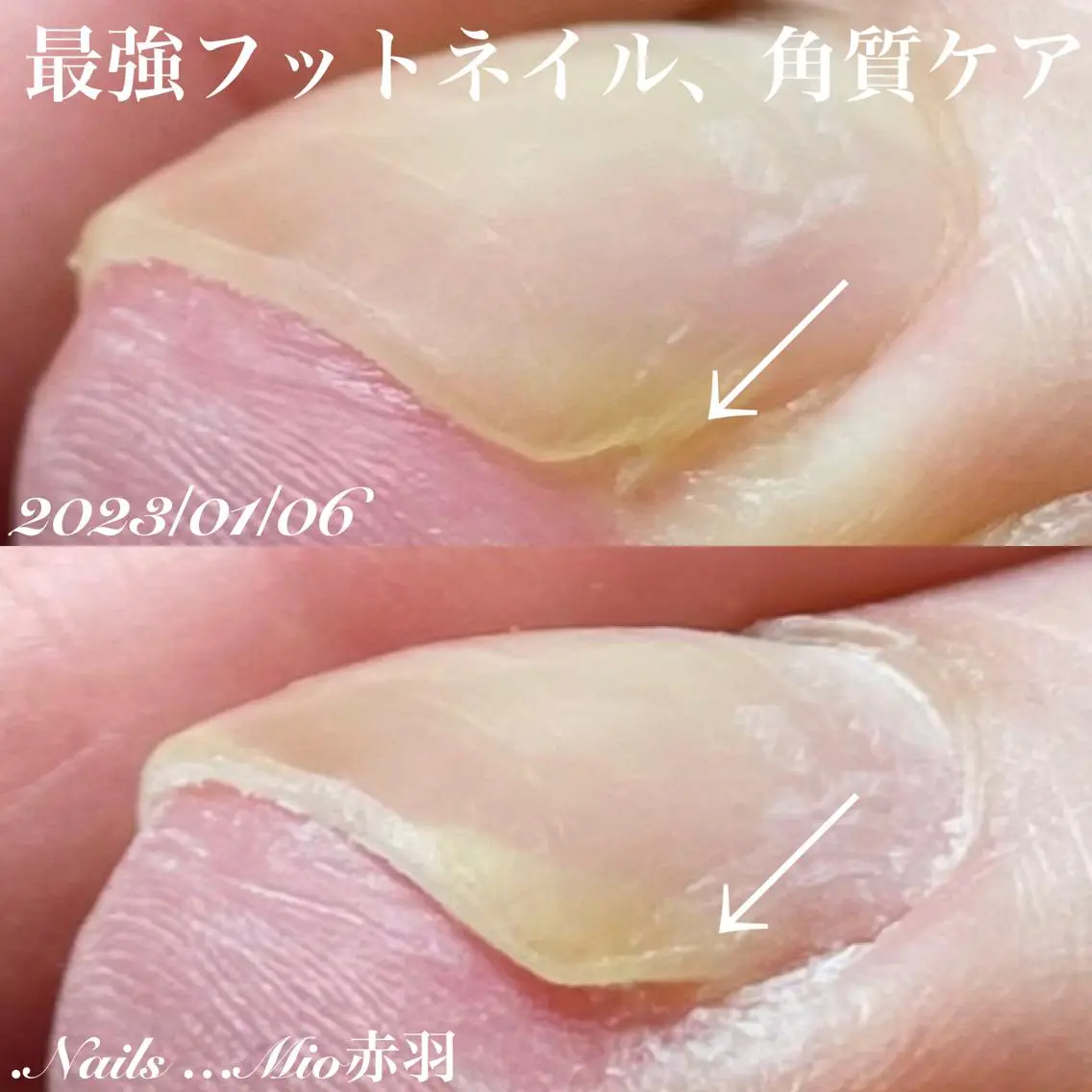 ネイル フットネイル フットネイル .Nails Mio 赤羽西ネイルサロンのネイルデザイン