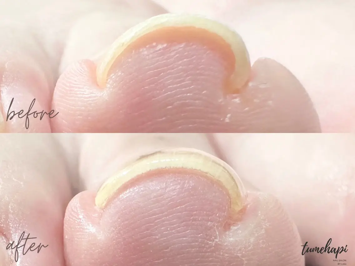 ネイル tumehapi junaのネイルデザイン