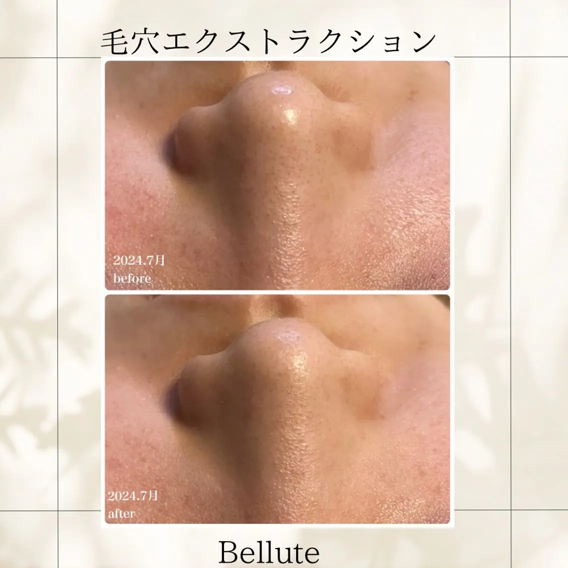 エステ リラク ピーリング専門店 Belluteのエステ・リラクイメージ