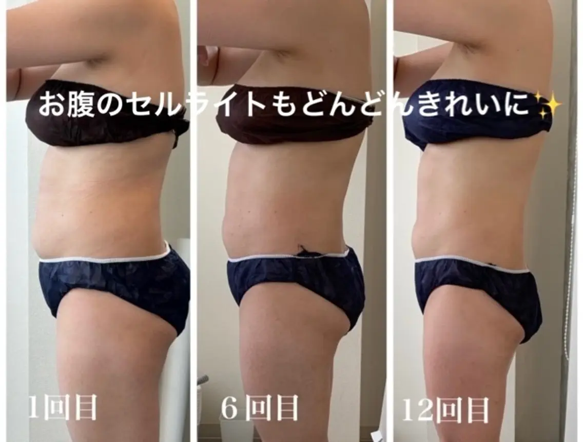 骨盤矯正ダイエット 結果出し＊痩身マシンのエステ・リラクイメージ