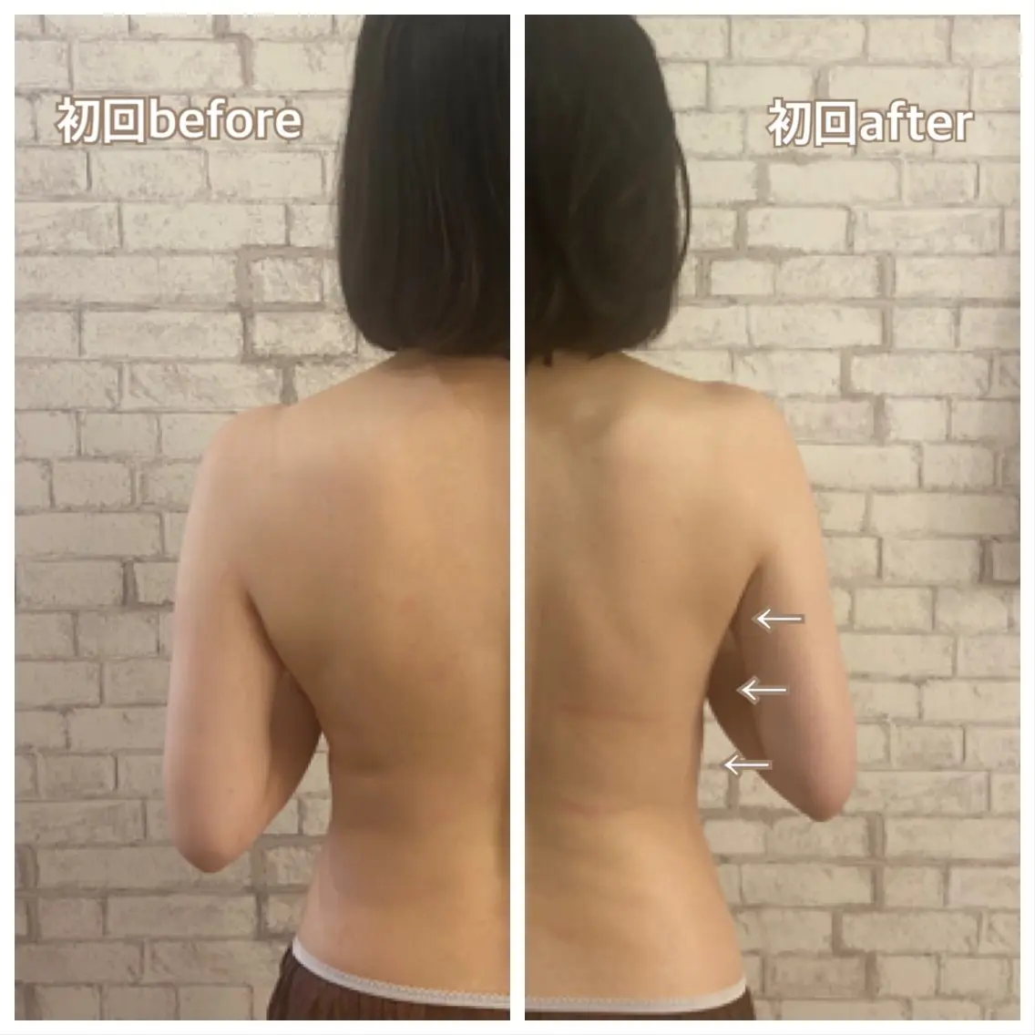 【小顔矯正】 salonaceのエステ・リラクイメージ