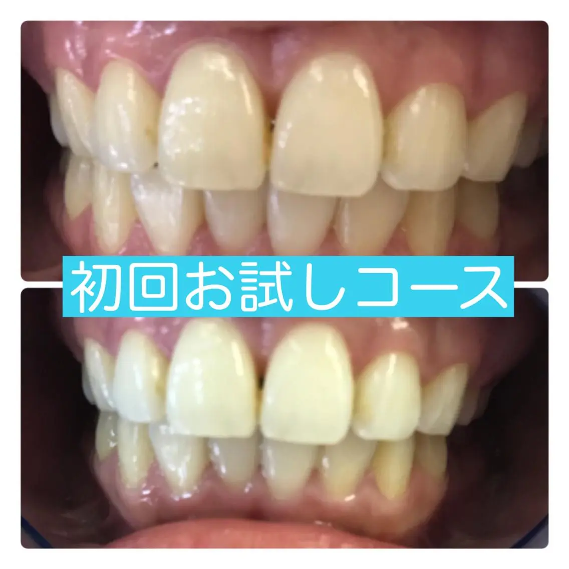 ホワイトニングルーム 横浜店のその他イメージ