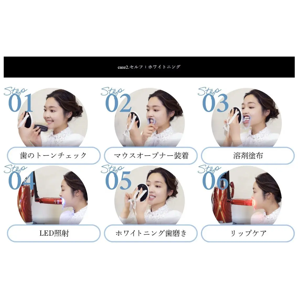 【アンケートにご協力いただける方限定】​〜​セルフホワイトニング​〜​30minの写真