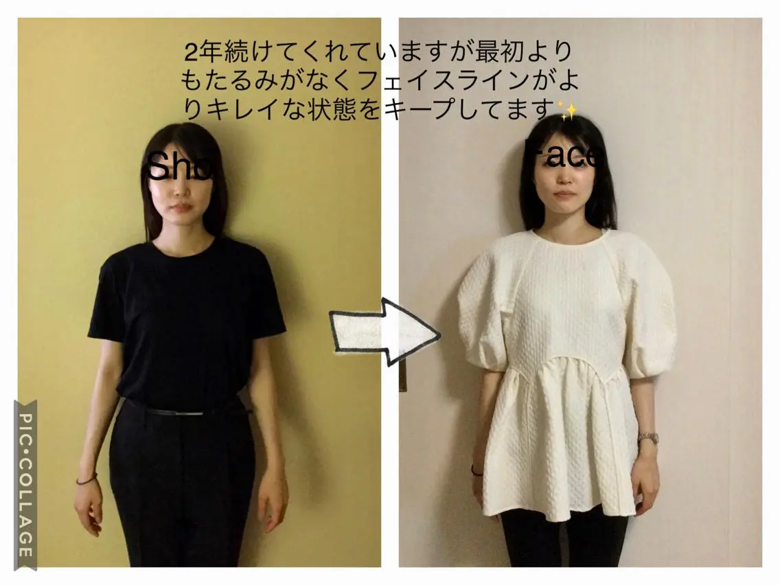 エステ リラク 小顔矯正Sho  FaceDesignのエステ・リラクイメージ