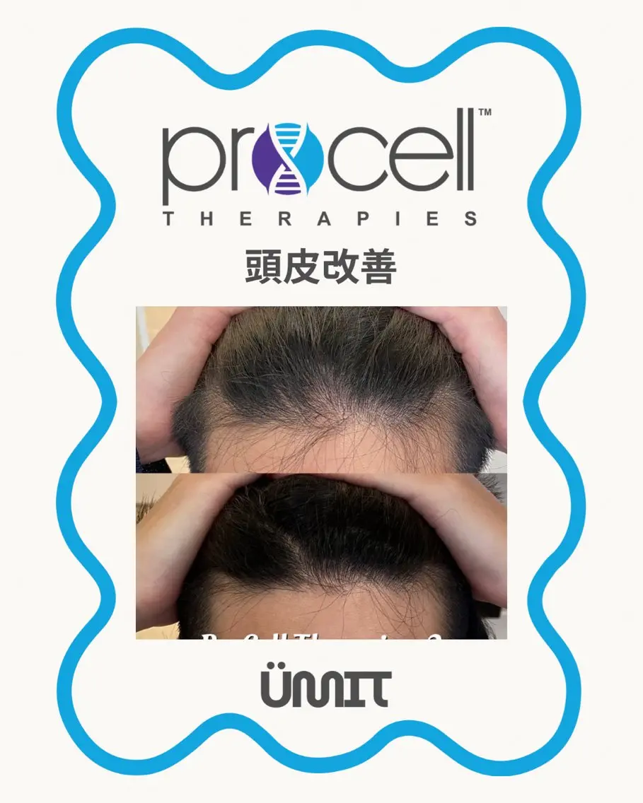 ヘッドスパ Ümit（ユミト） プロセルセラピーズのネイルデザイン