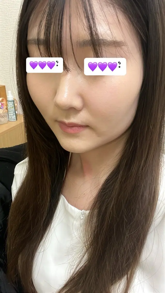 高岡 うさのエステ・リラクイメージ