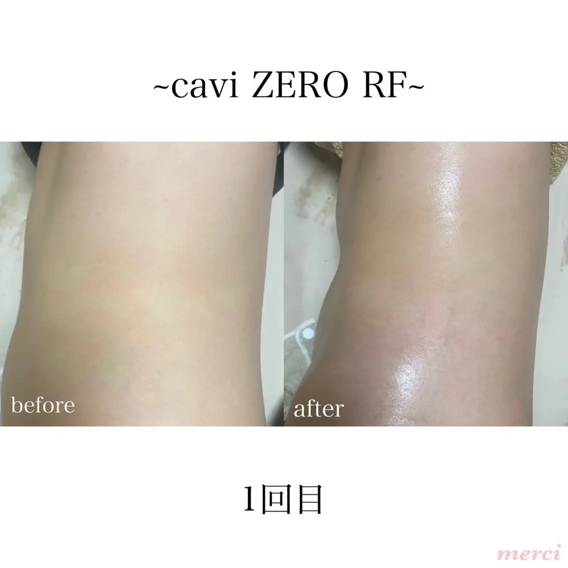 salon merci和泉のエステ・リラクイメージ