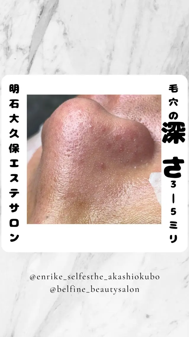 夕希 毛穴と脱毛特化サロンのエステ・リラクイメージ