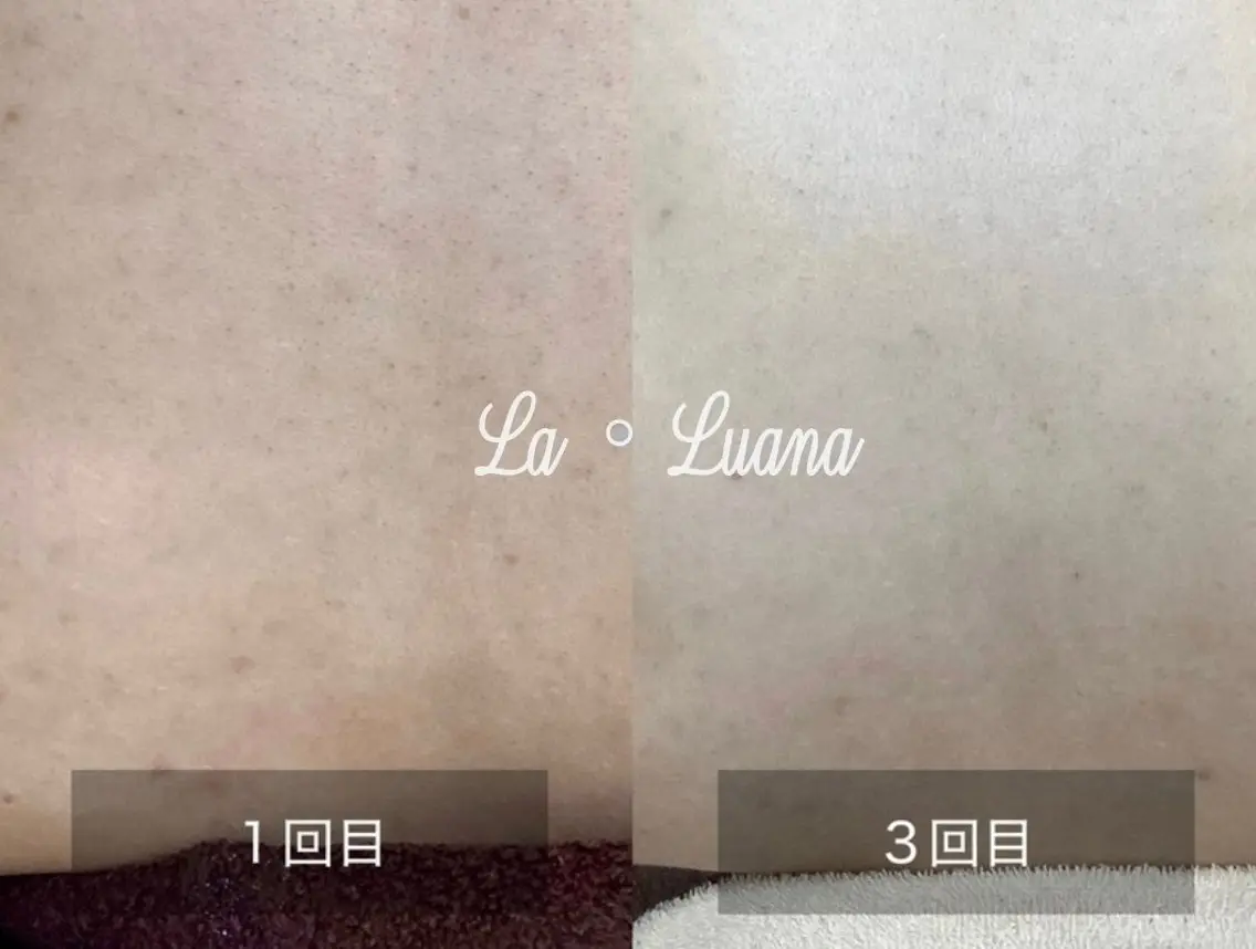 La・Luana Cocoroのエステ・リラクイメージ