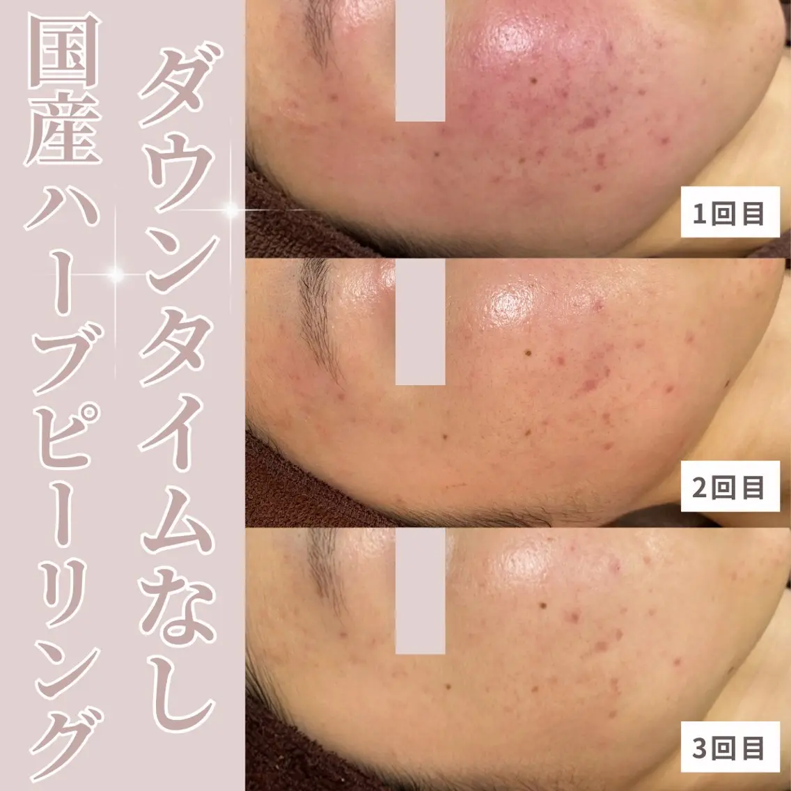 エステ ResetLab 佐藤 風香のエステ・リラクイメージ