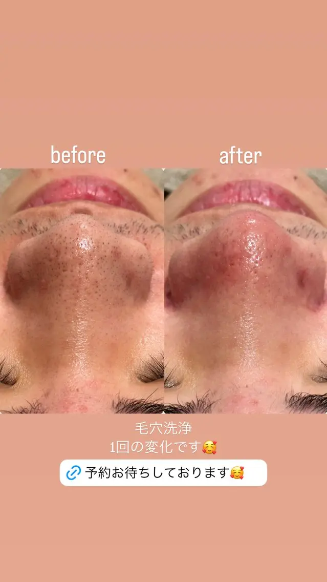 mumu beautyのエステ・リラクイメージ