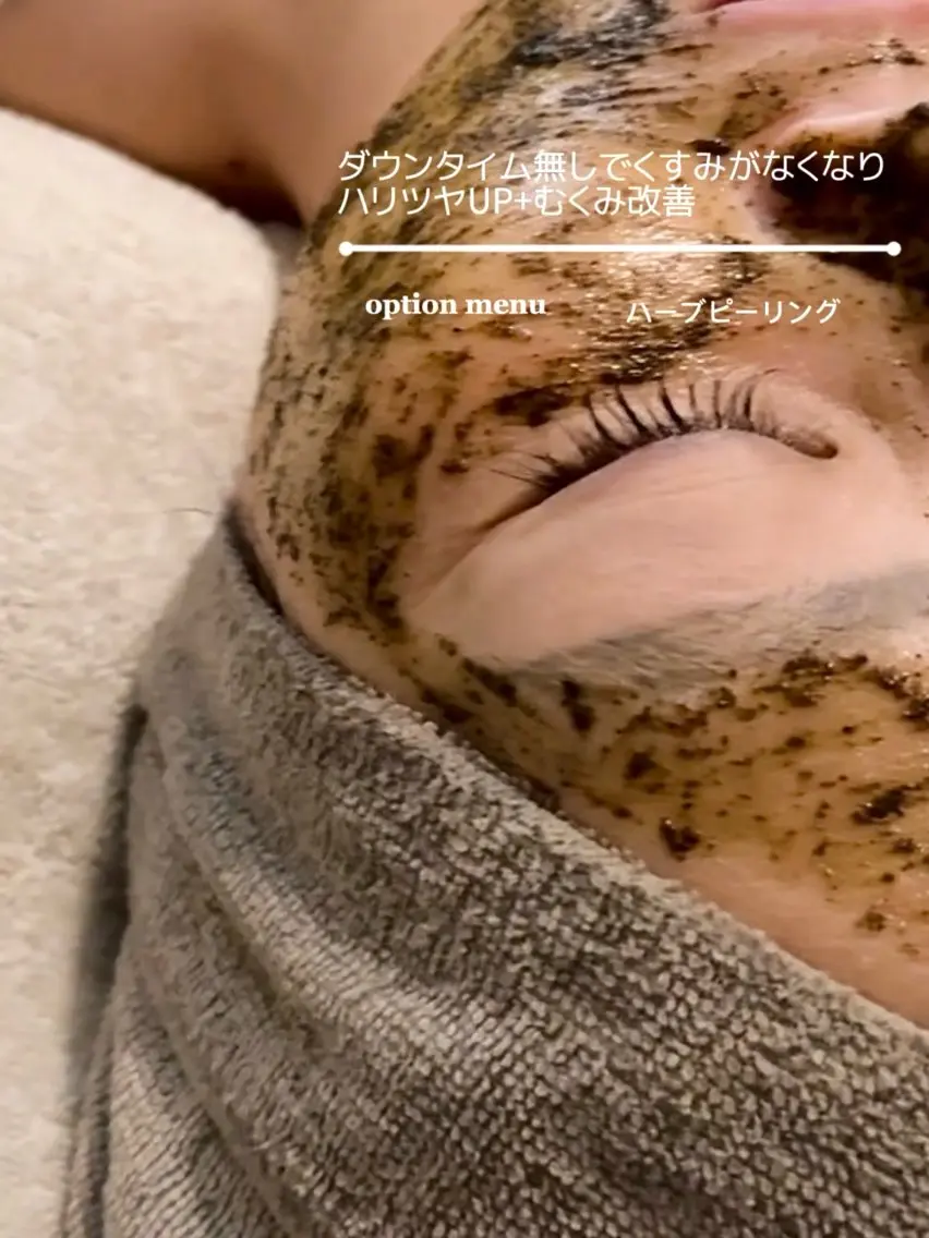 ミニモ限定お試し体験🌿˗ˋˏ 肌質改善ハーブピーリングˎˊ˗🫧の写真