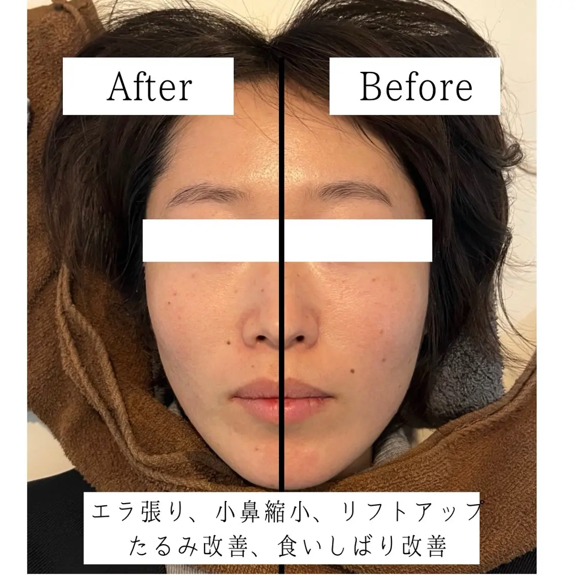 コアの木整骨院高津院 藤内尚志のエステ・リラクイメージ