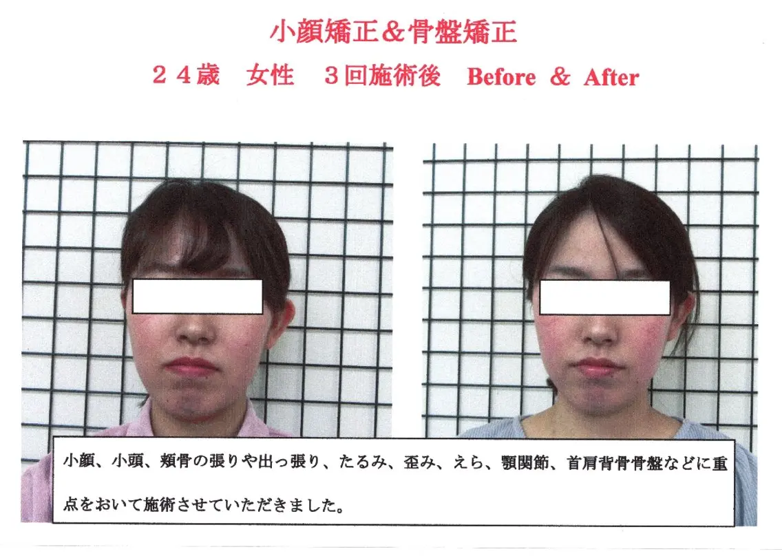 小顔効果をキープ★本格小顔整体+筋膜整体+骨盤整体の写真