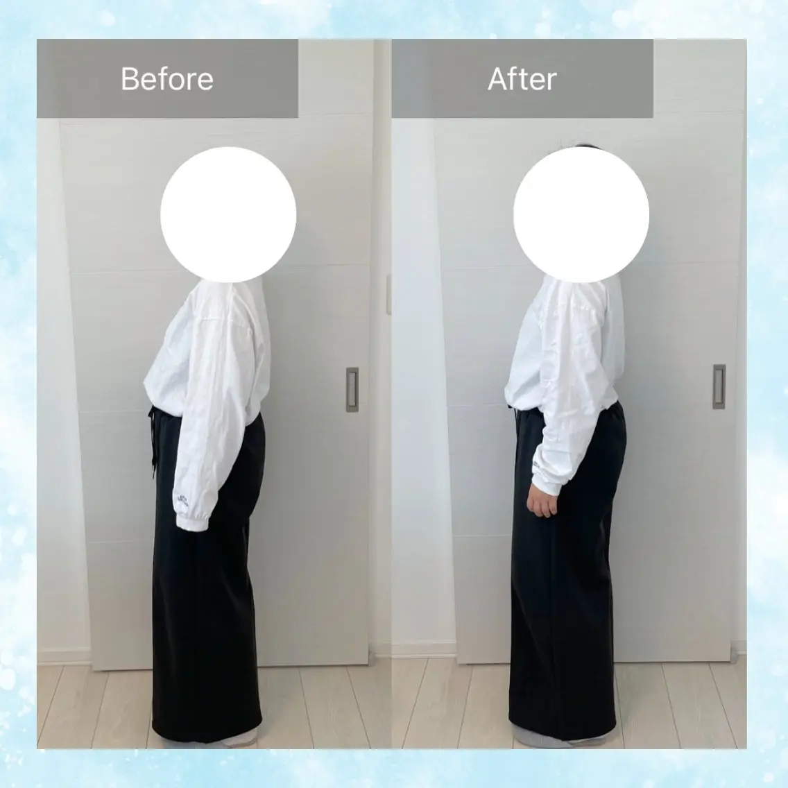 骨盤矯正の写真