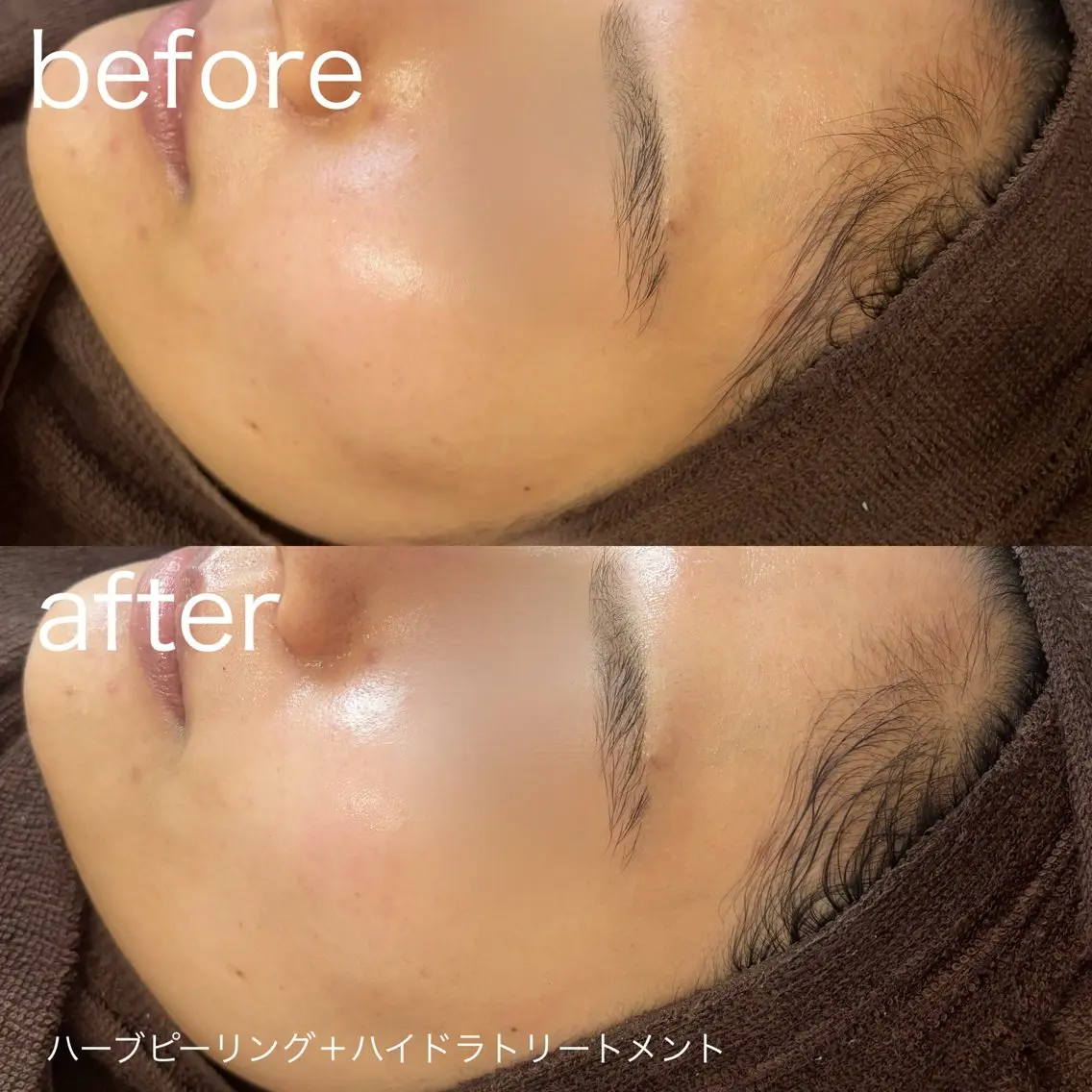 脱毛 lulularico Yuのネイルデザイン