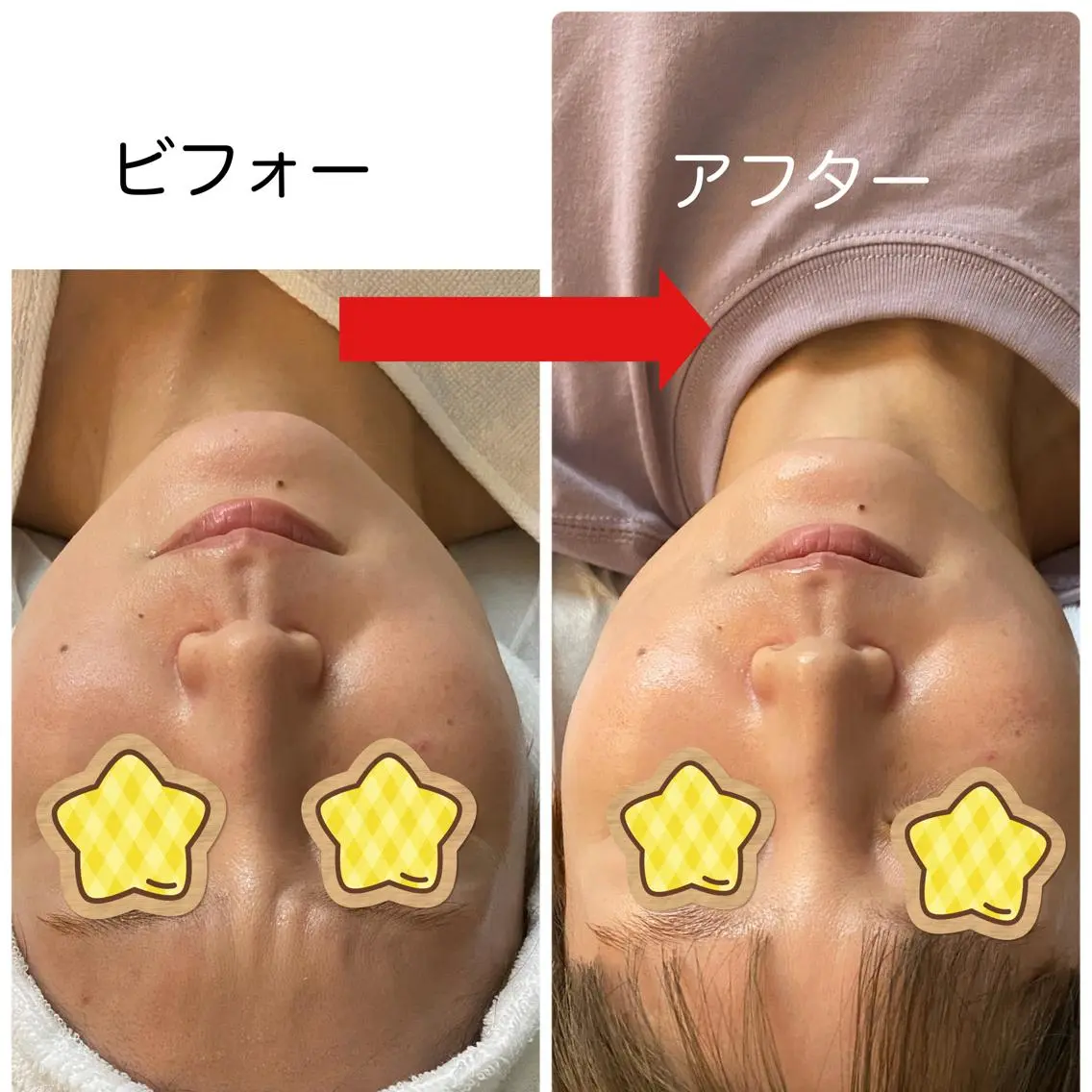 スペシャルエステ(マッサージ＋超音波＋トラブル別パック)(60分)の写真