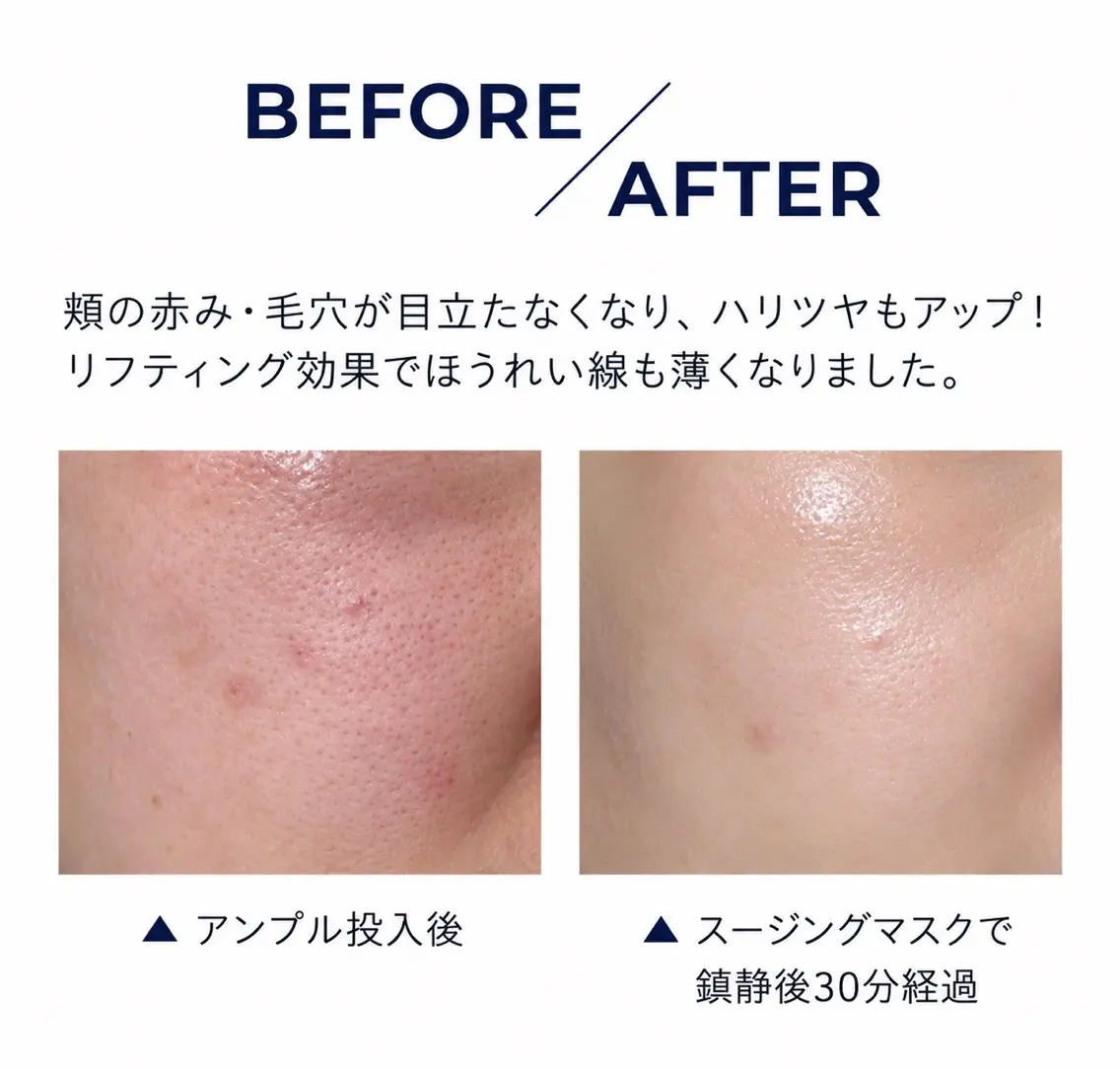 その他 北堀江/大人の本気の 肌質改善 ranのエステ・リラクイメージ