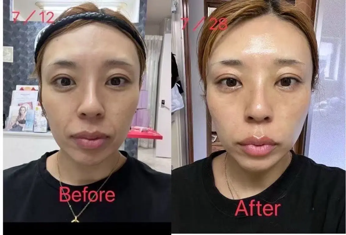 エステ ラムーン アイラッシュ&ヘアメのマツエク・マツパデザイン