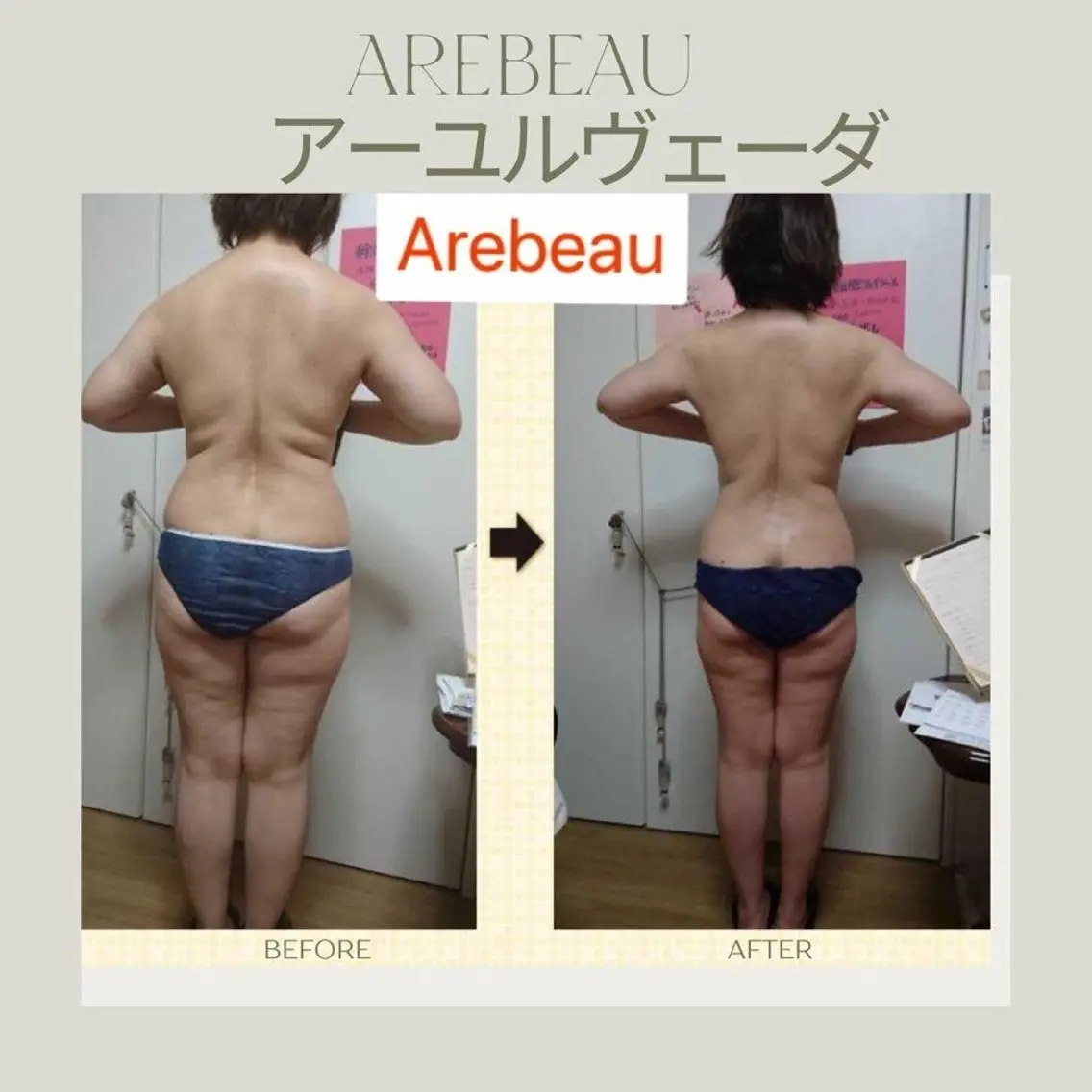 Arebeau 健康的にダイエットのエステ・リラクイメージ