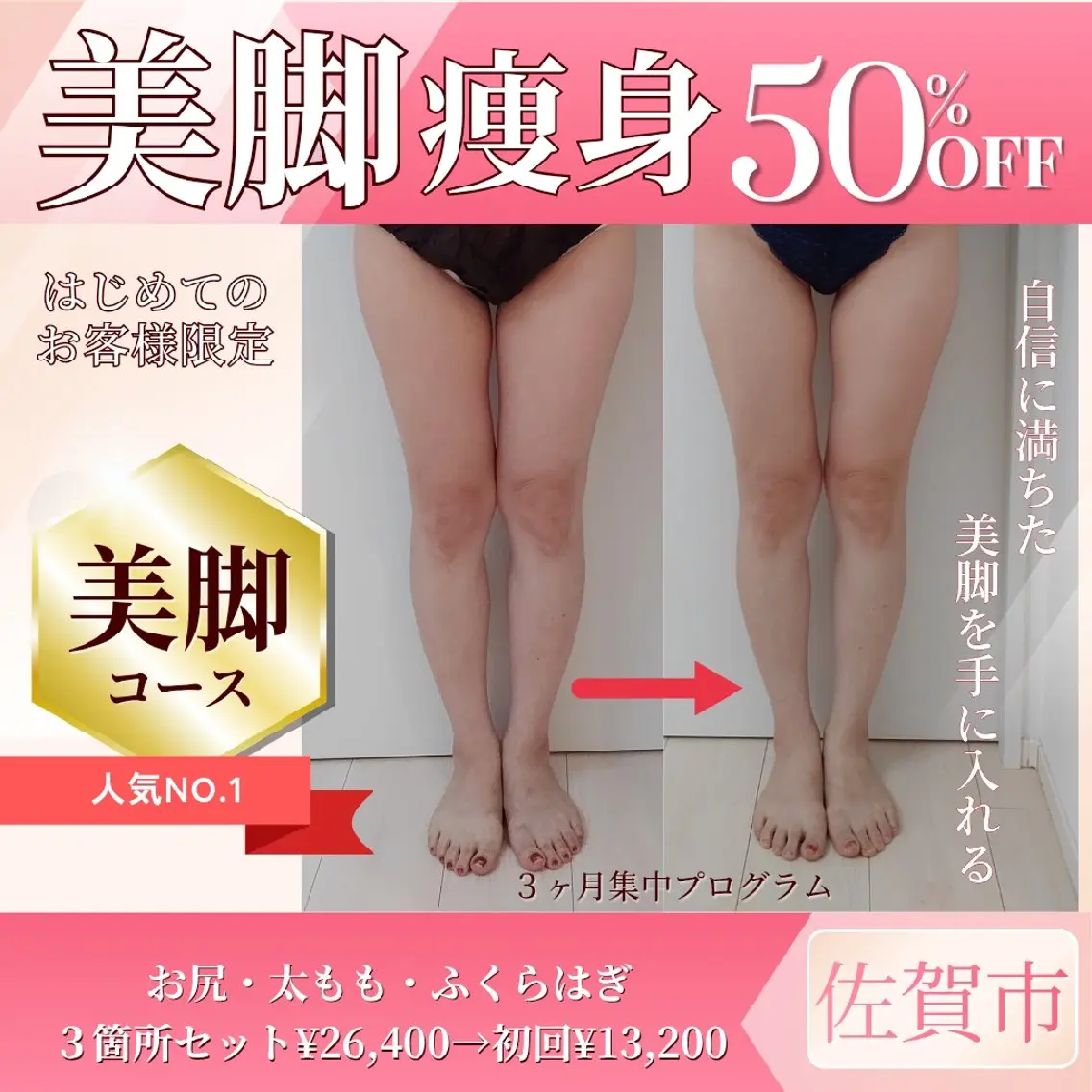 佐賀市│ダイエット│痩身エステ(太もも・ふくらはぎ・お尻)3箇所お得セットの写真