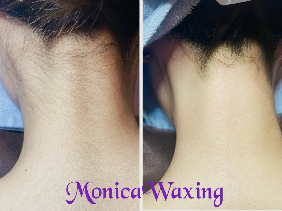 脱毛 Monica Waxingのエステ・リラクイメージ
