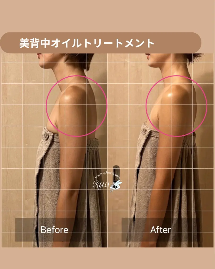 【頭痛、睡眠改善】 salon RUUのエステ・リラクイメージ