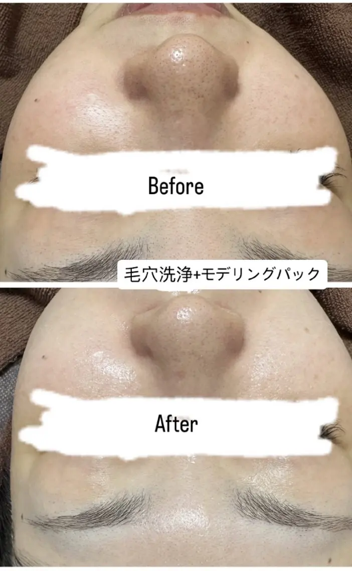 看護師　桐山 まどかのエステ・リラクイメージ