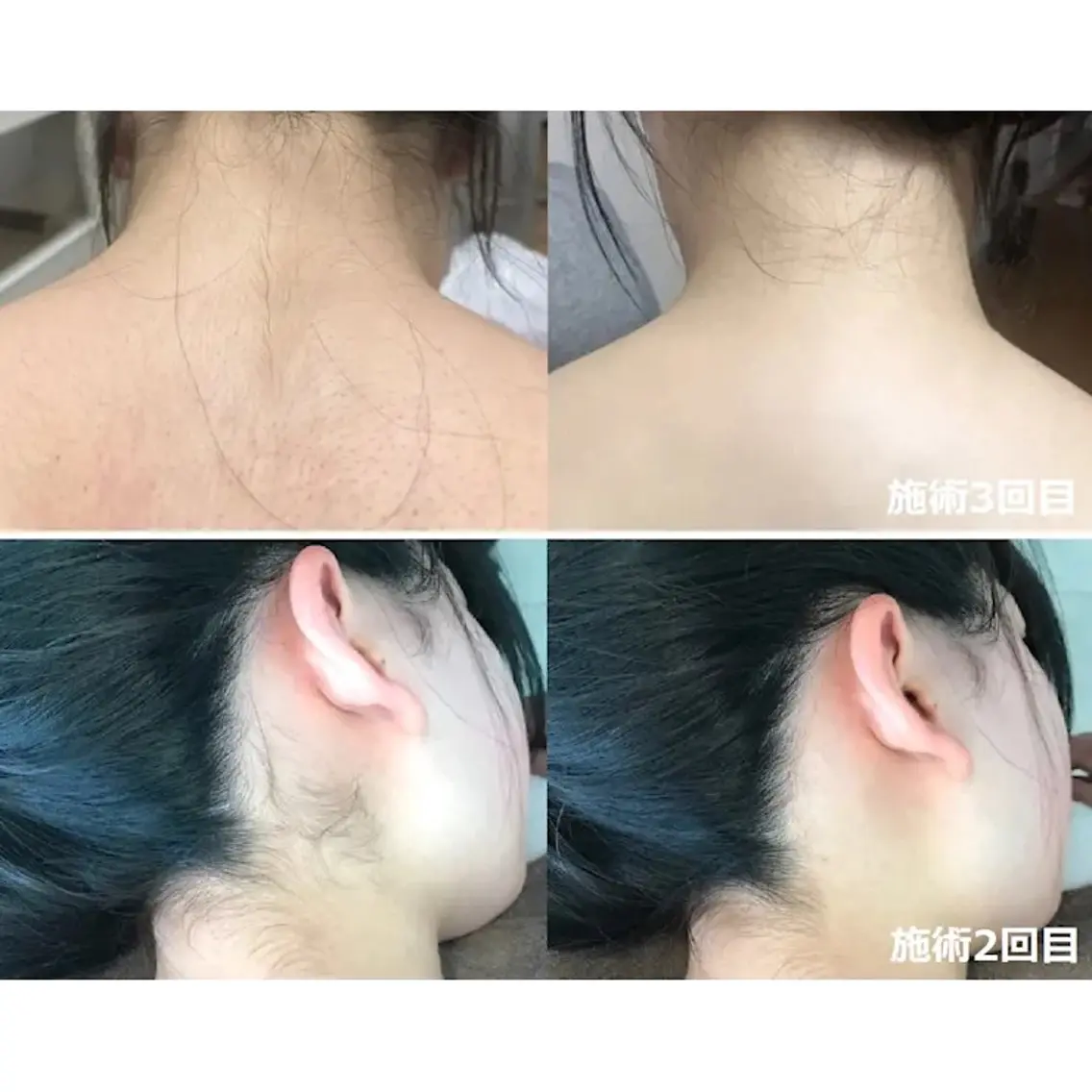 脱毛 salon Deesのマツエク・マツパデザイン