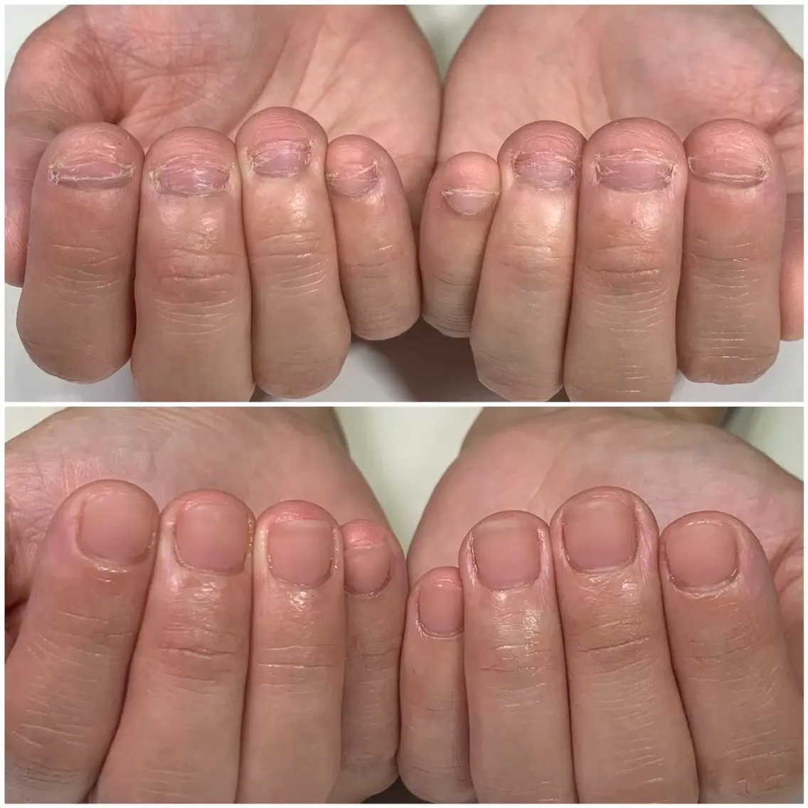 ネイル 雀宮 自爪育成 Re.nail〜寺本のネイルデザイン
