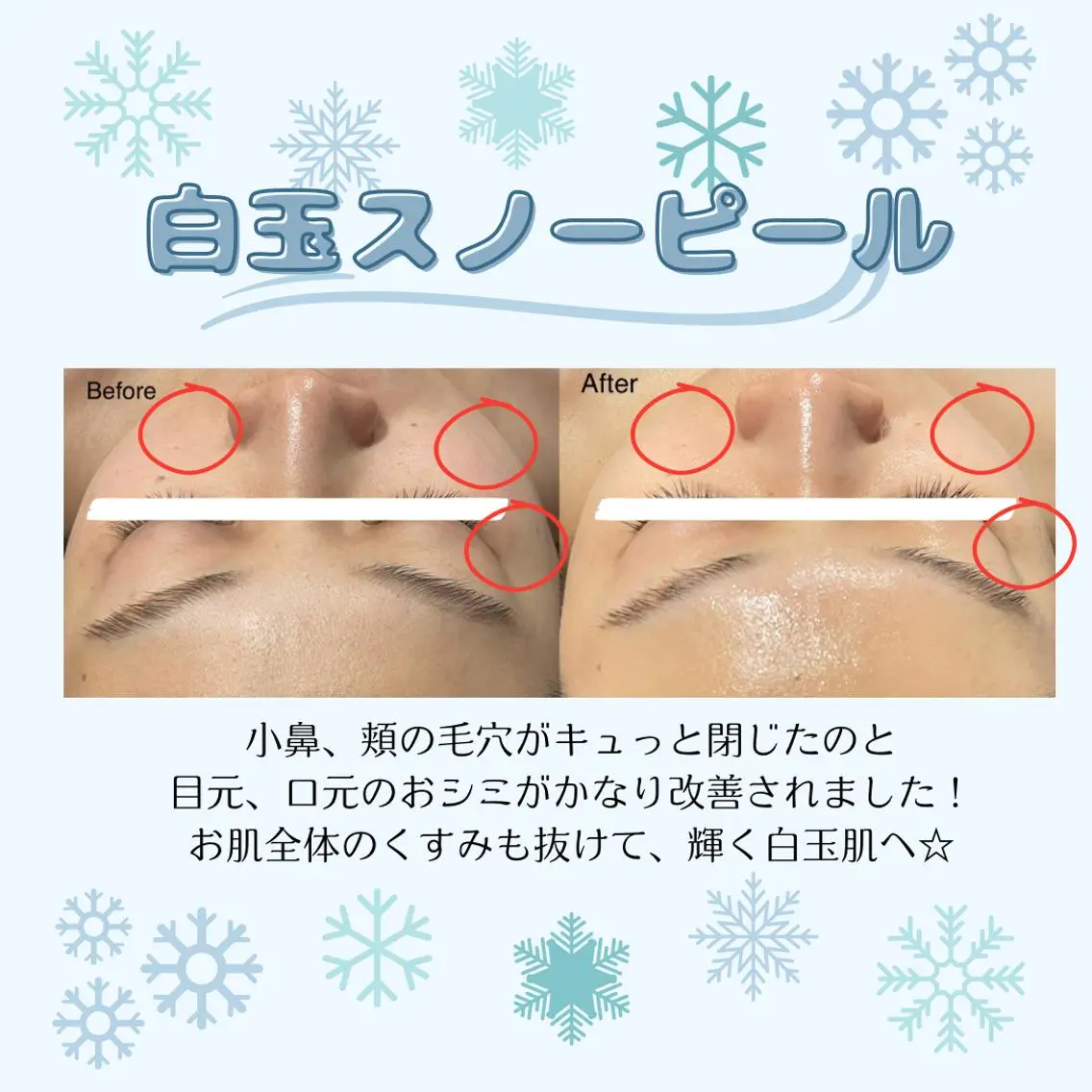 🌷毛穴エステ レイビスMURA🌷のエステ・リラクイメージ