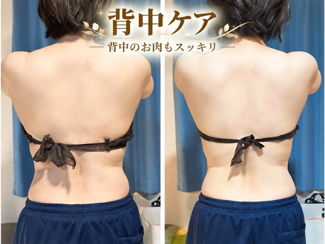 秋山 暢佑のエステ・リラクイメージ