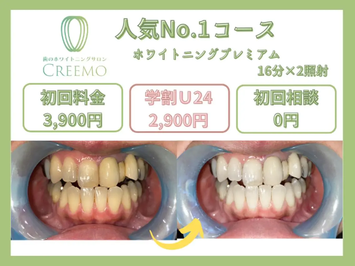 その他 歯のホワイトニング HARU南浦和のその他イメージ