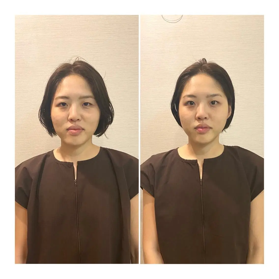 即小顔♥️美容鍼× ハーブピーリングのその他イメージ