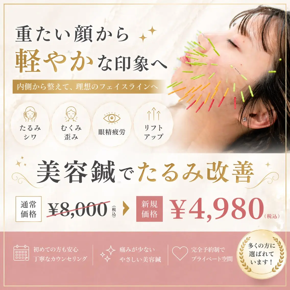 【人気No.1メニュー】美容鍼(たるみ 小顔 ほうれい線 眼精疲労 顔のむくみ リフトアップ たるみ)(60分)の写真