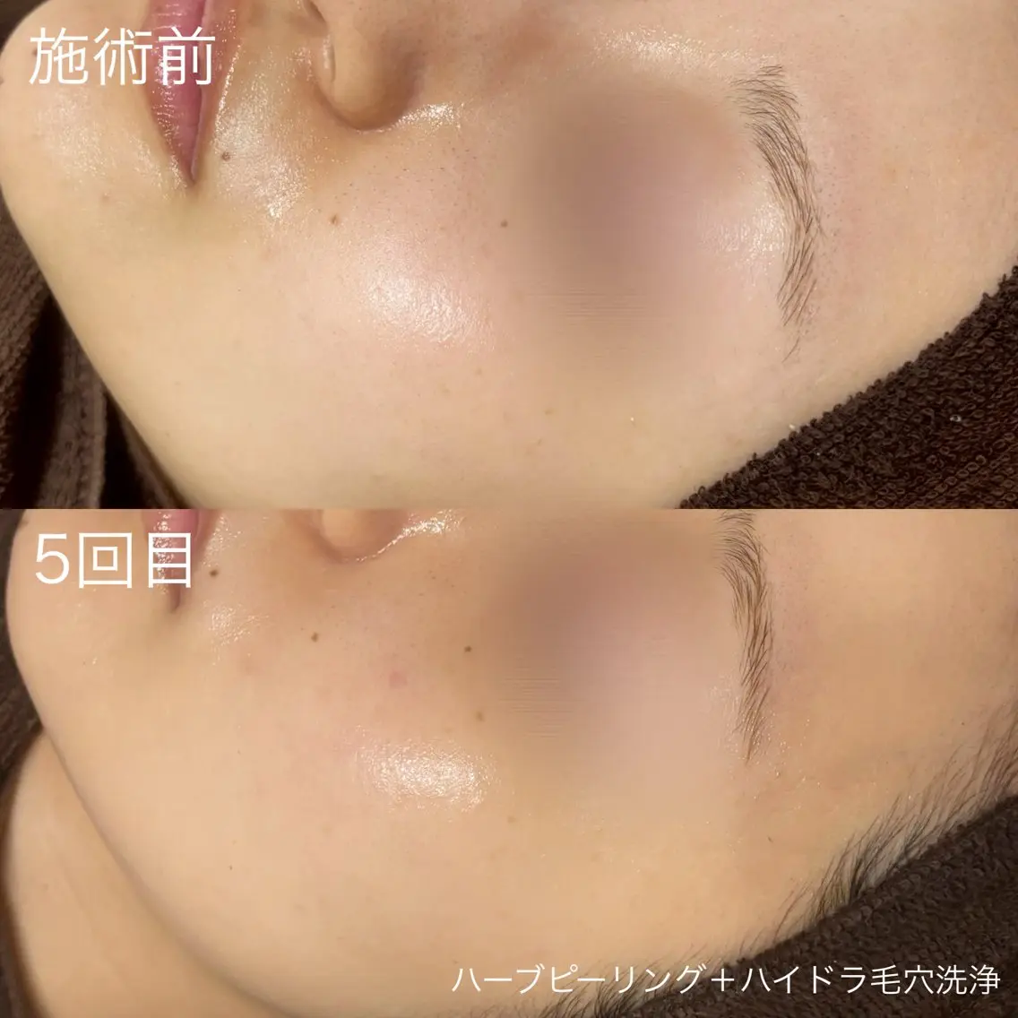 脱毛 lulula ricoのエステ・リラクイメージ