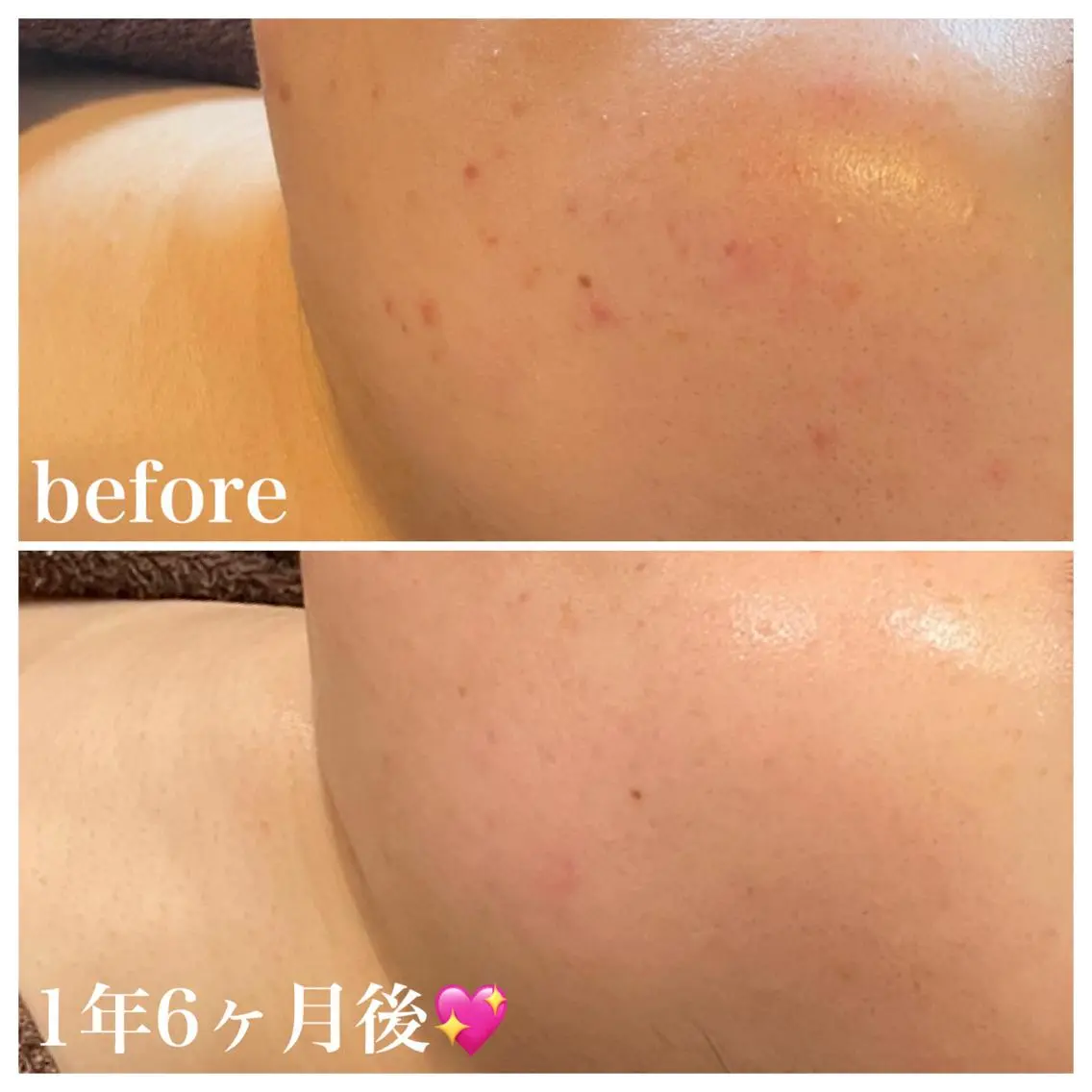 エステ 浜野 恵美のエステ・リラクイメージ
