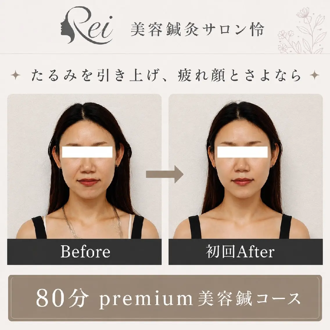 エステ リラク 美容鍼灸サロン怜 -Rei-のエステ・リラクイメージ