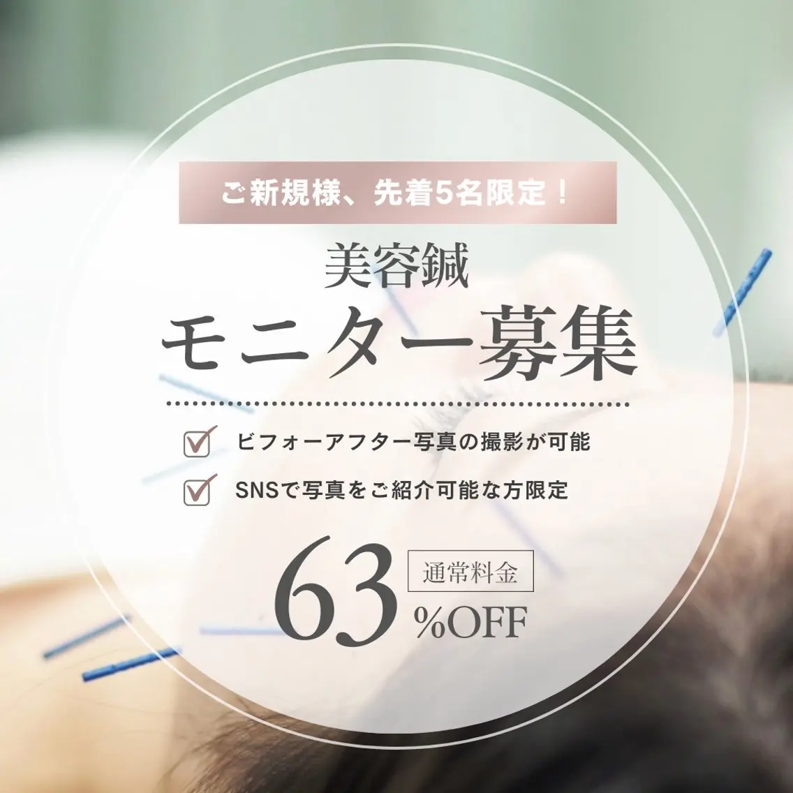 エステ リラク 美容鍼灸サロン Chamibelleのエステ・リラクイメージ